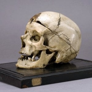Il cranio del brigante Giuseppe Villella, conservato al Museo Lombroso